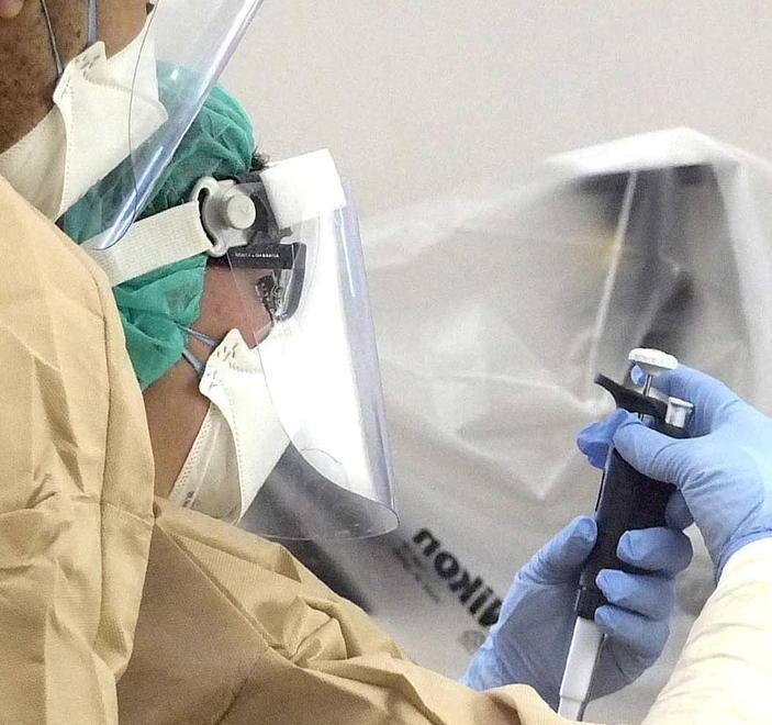 Cisanello, scoperto il virus nell’addome di un paziente 