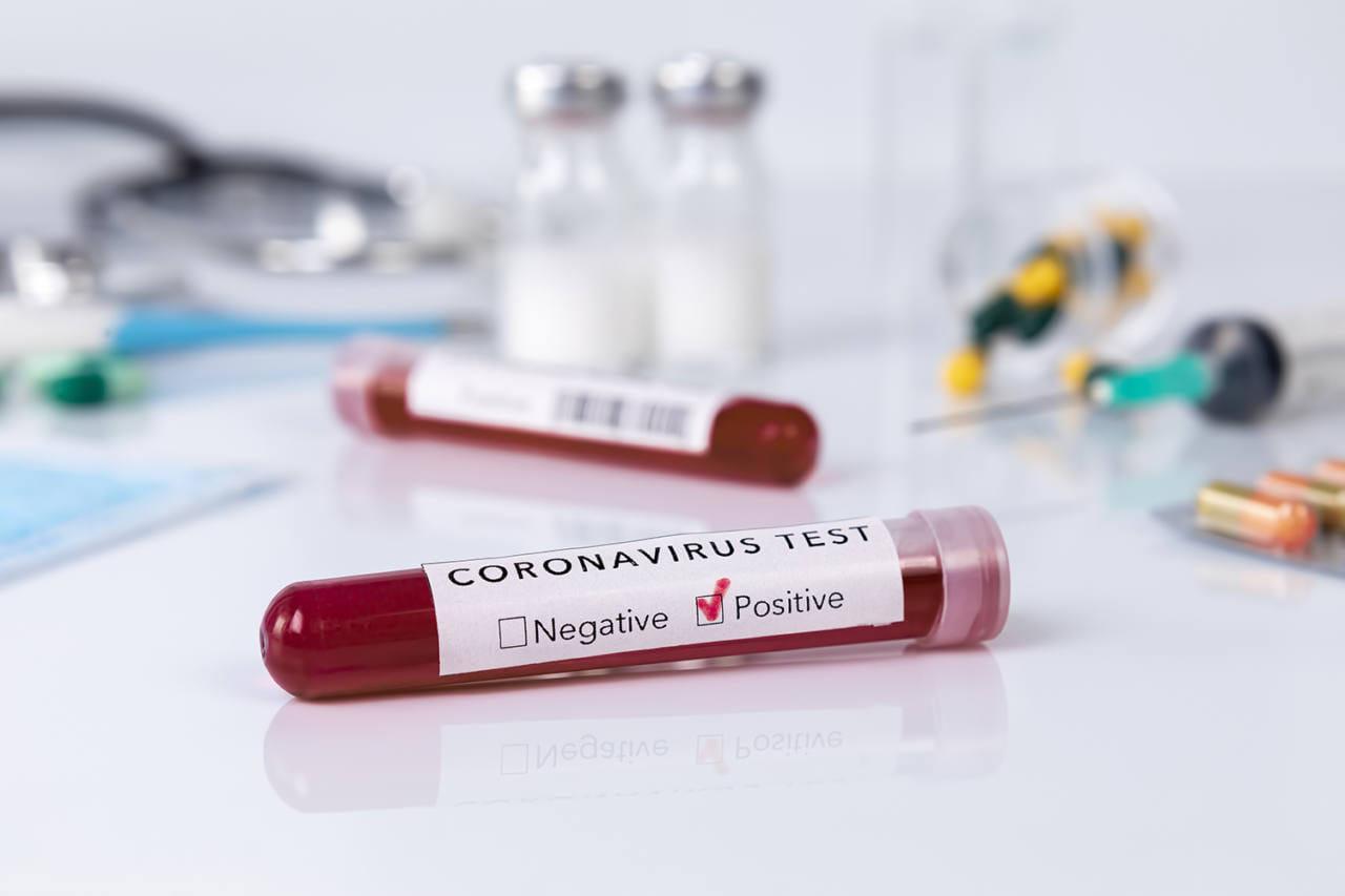 A Lucca oltre 200 positivi, ma il virus rallenta: 64 guariti 