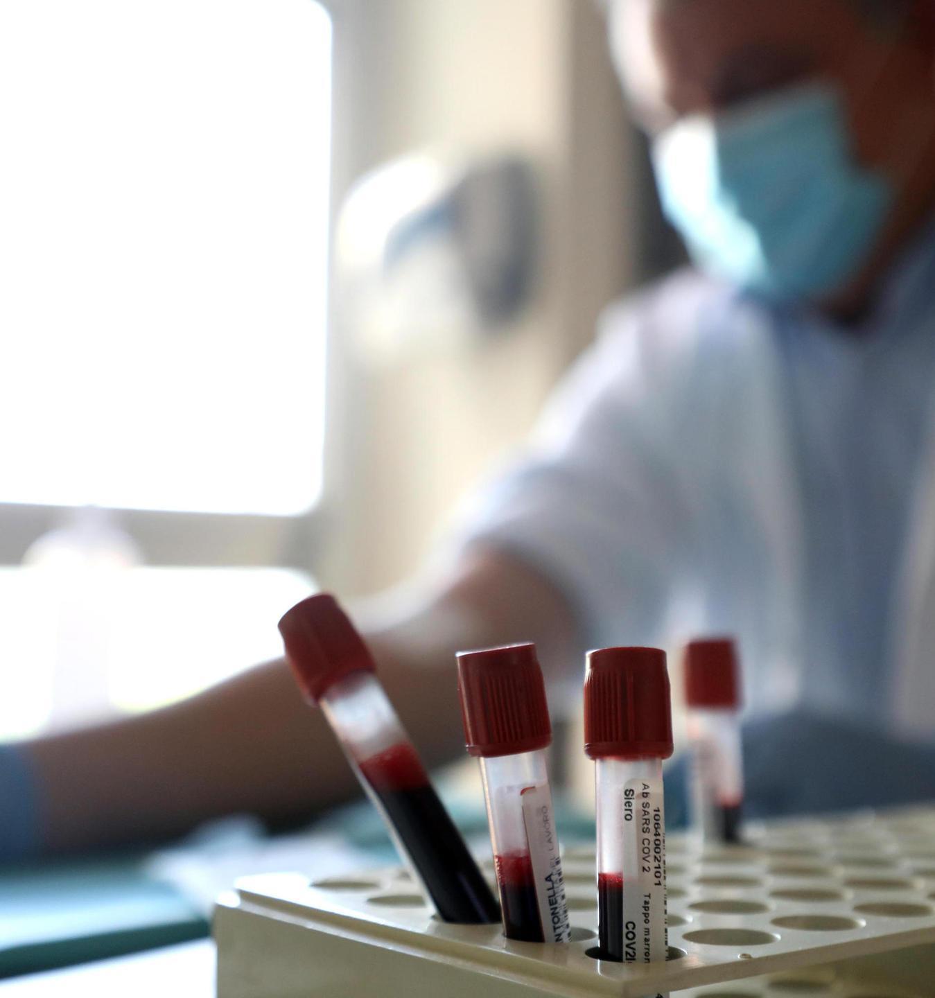 Cresce il numero dei contagi i positivi ora salgono a 27 