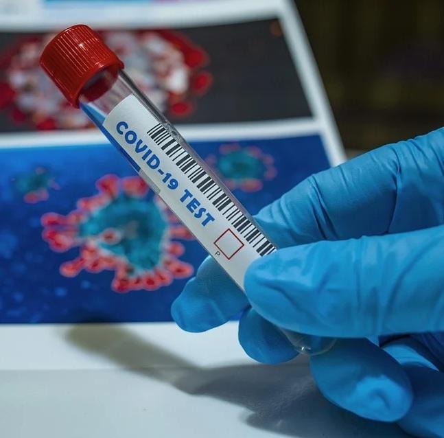 Banale influenza, anzi no: tutti gli errori degli scienziati sul coronavirus