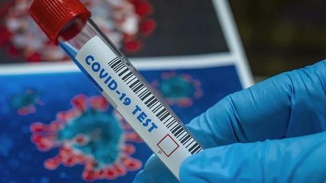 Banale influenza, anzi no: tutti gli errori degli scienziati sul coronavirus