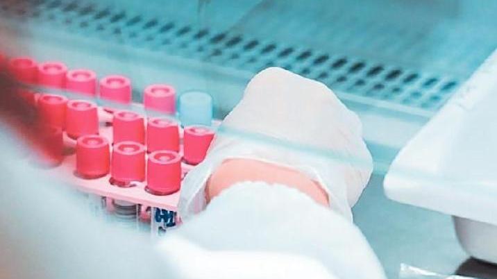 Tamponi per rilevare la positività al coronavirus