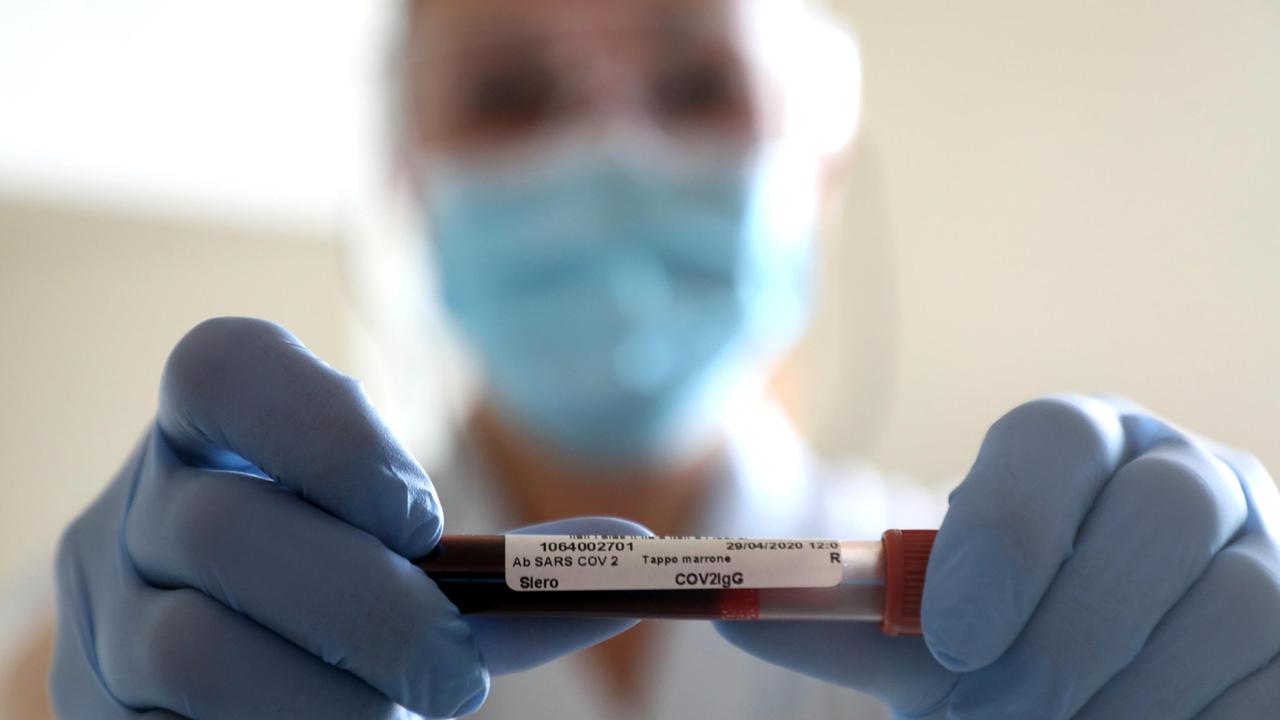 Coronavirus, in Toscana 15 nuovi casi, 2 decessi e 79 guarigioni