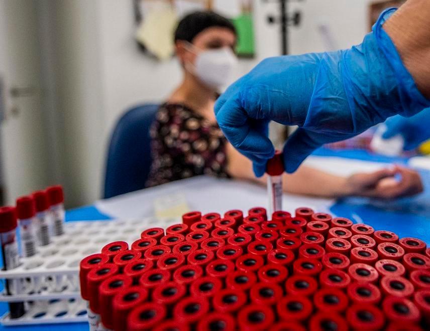 Dei 5mila casi reggiani l’82% non è più malato 