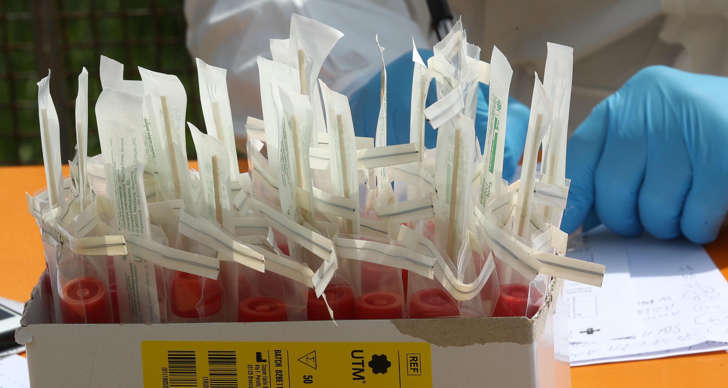 I test sierologici