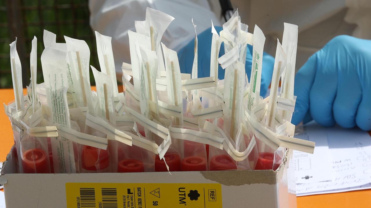 I test sierologici