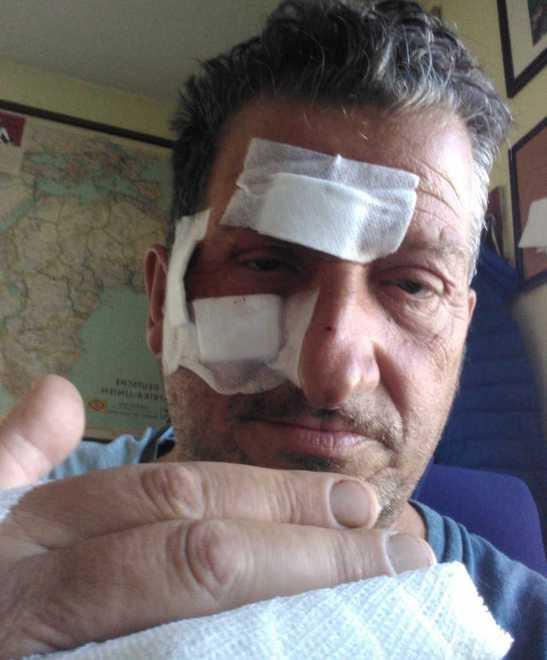 Picchiato in pizzeria da sette giovani «Calci, pugni e un bicchiere in faccia» 