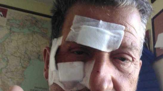 Picchiato in pizzeria da sette giovani «Calci, pugni e un bicchiere in faccia»