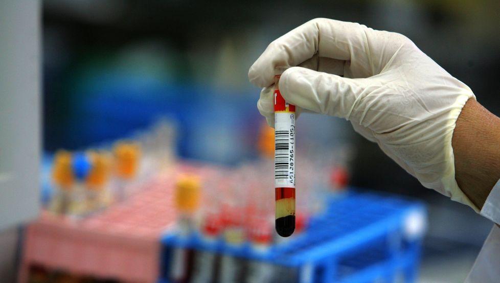Analisi del sangue, a Modena il 9 luglio