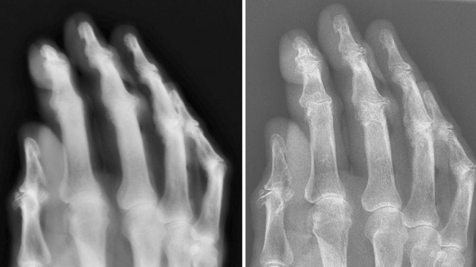 Radiografia alla mano: meglio il privato
