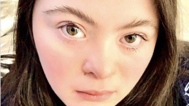 Gucci sceglie Ellie, la modella con la sindrome di down, per la nuova campagna