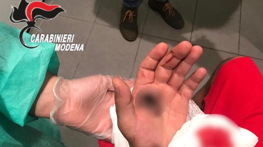 Carpi, si spara in una mano e finge una rapina: denunciato