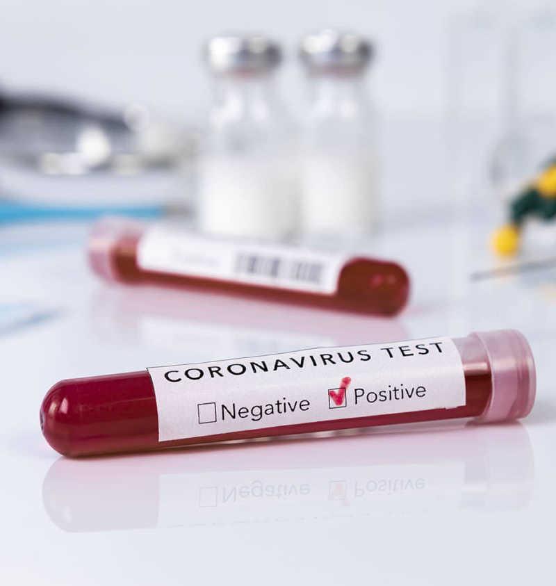 Covid, altri tre casi di positività nella Piana In quarantena una ventina di persone 