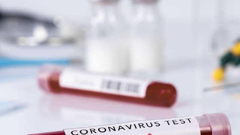 Covid, altri tre casi di positività nella Piana In quarantena una ventina di persone