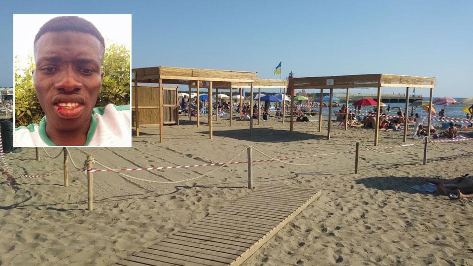 La spiaggia dell'aggressione e Mamady Dabakh Mankara con il labbro spaccato
