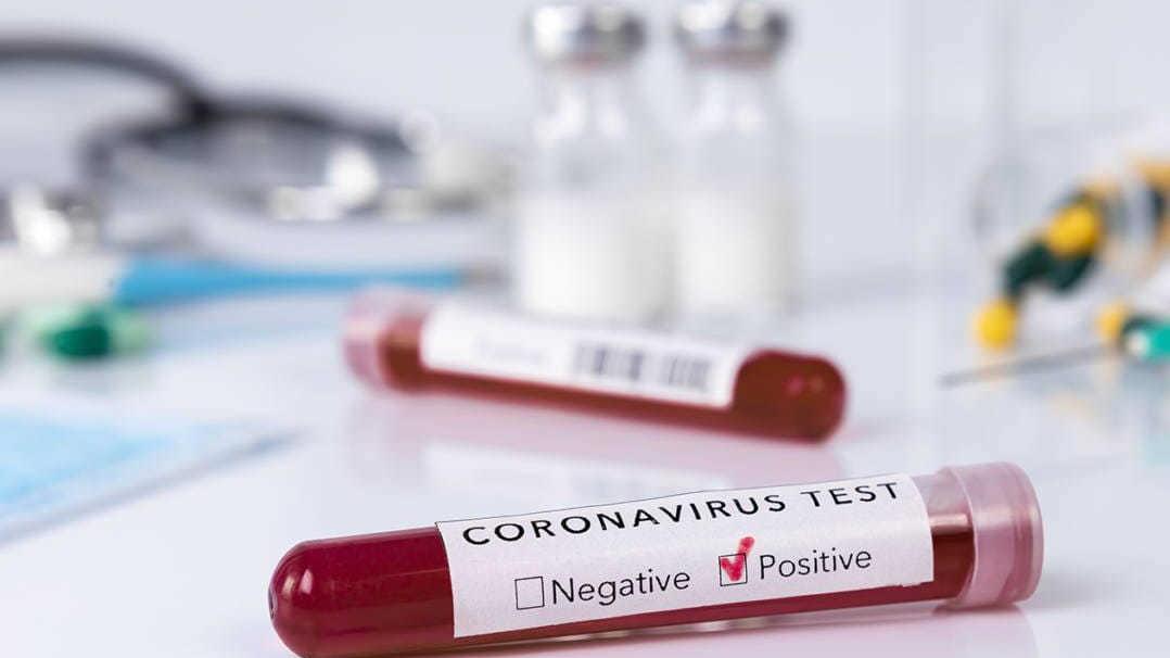 Covid, tre positivi a Capannori Contagiate una madre e la figlia