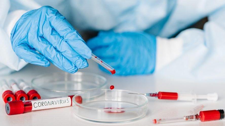 Coronavirus, altri 69 positivi in Emilia Romagna e un deceduto. A Modena 4 nuovi casi