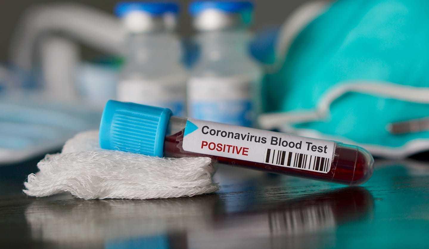 Covid, due nuovi positivi a Lucca e Porcari Pranzo in famiglia fa 18 casi