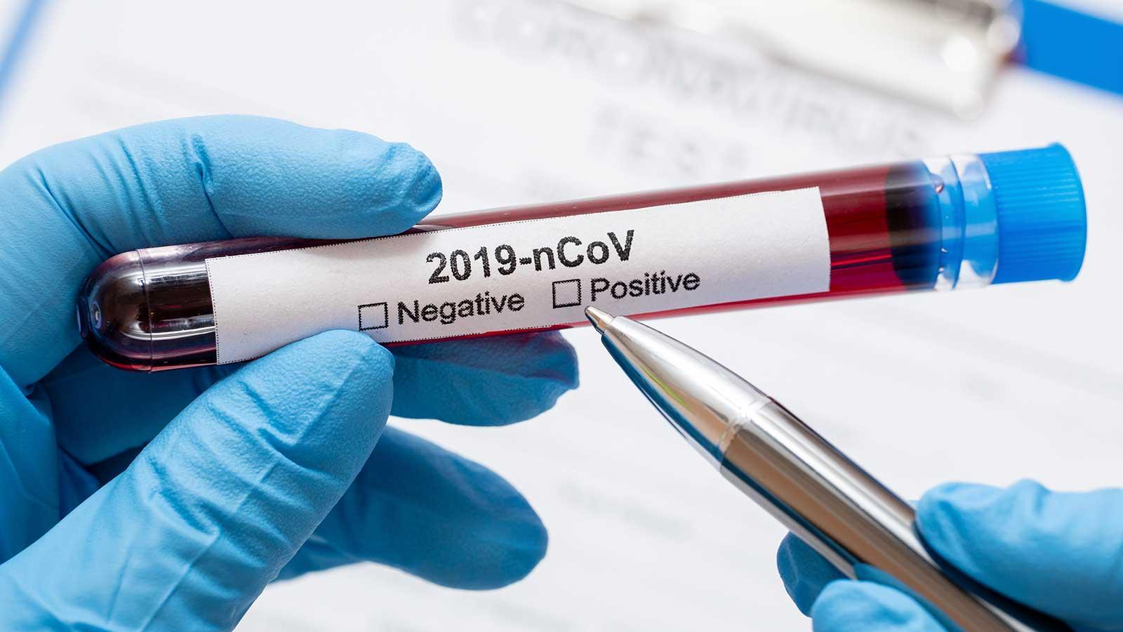 Coronavirus in Toscana: 38 nuovi casi (1 collegato al Seven Apples), un nuovo decesso
