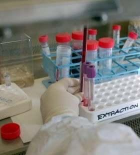 Positivo alunno dell’elementare scolari e maestre in quarantena 