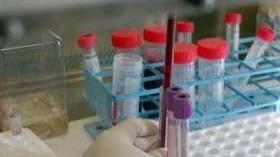 Positivo alunno dell’elementare scolari e maestre in quarantena