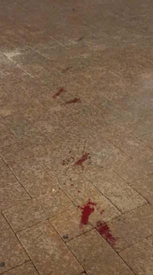 Accoltella la compagna e l’amico per gelosia 