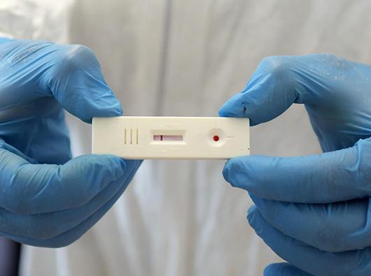 Screening sierologico nel laboratorio mobile 