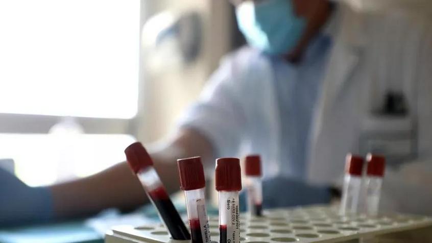 Coronavirus, azienda senese realizza un nuovo test screening immunitario in un'ora
