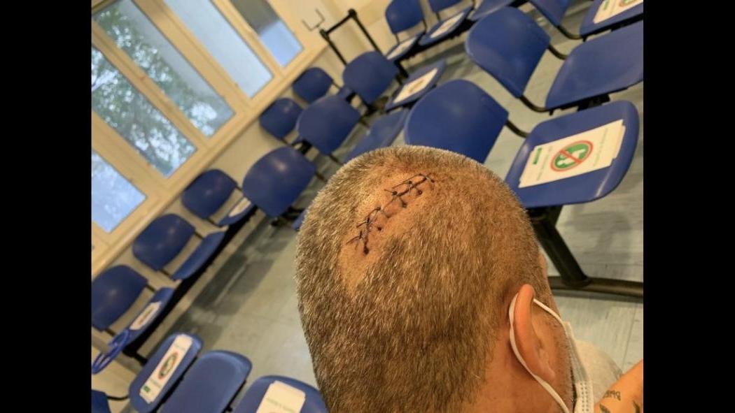 Parla l'uomo aggredito a Modena: «Mi ha massacrato a colpi di mazza ed è già in libertà»