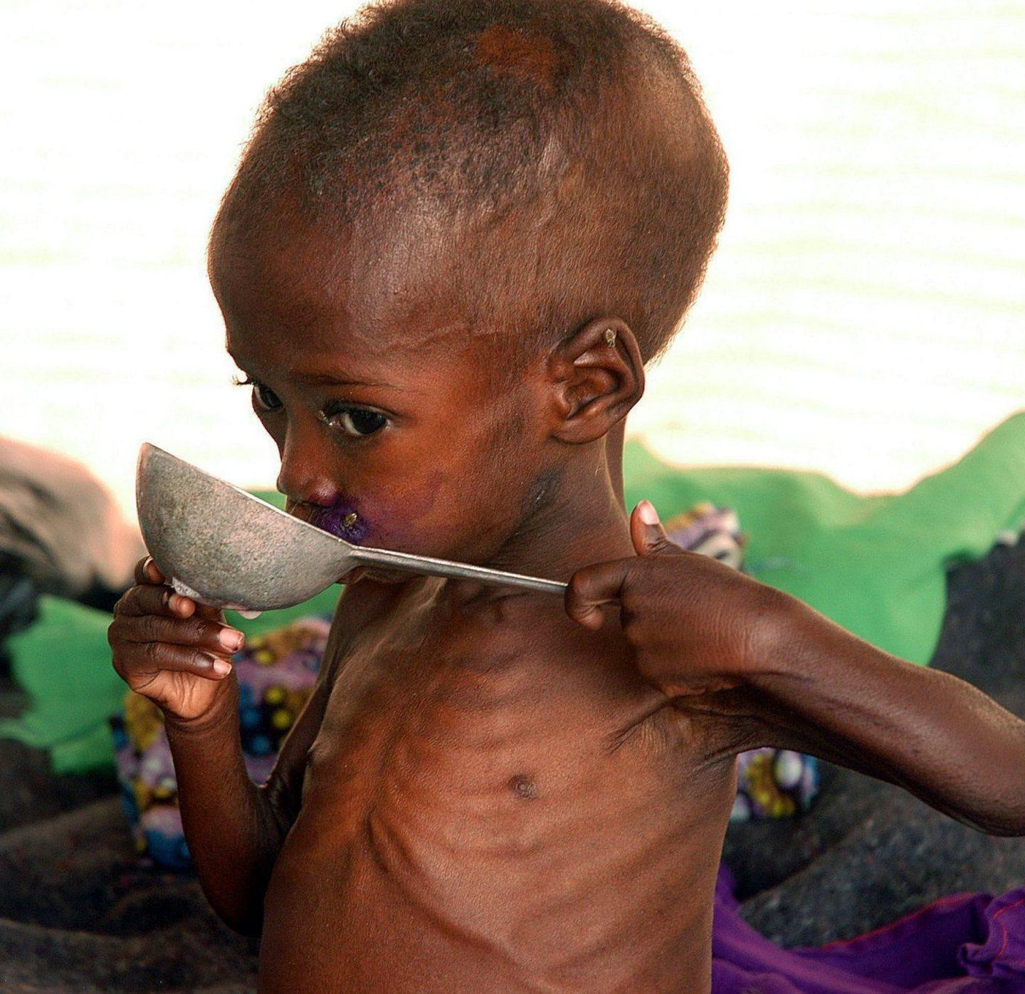 Pace, Nobel per la guerra alla fame 