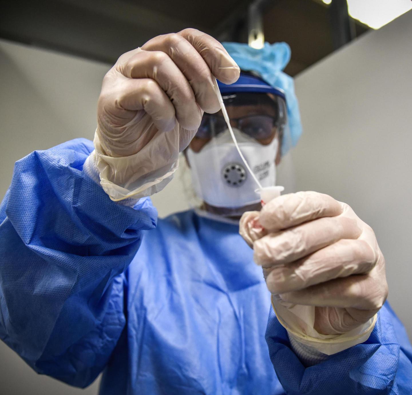 [EMPTYTAG]Tutti i test a disposizione per le diagnosi