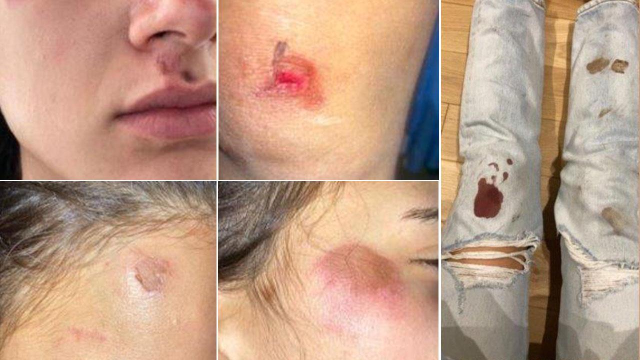 Studentesse aggredite e spinte a terra a Pisa per aver rifiutato un invito a bere 