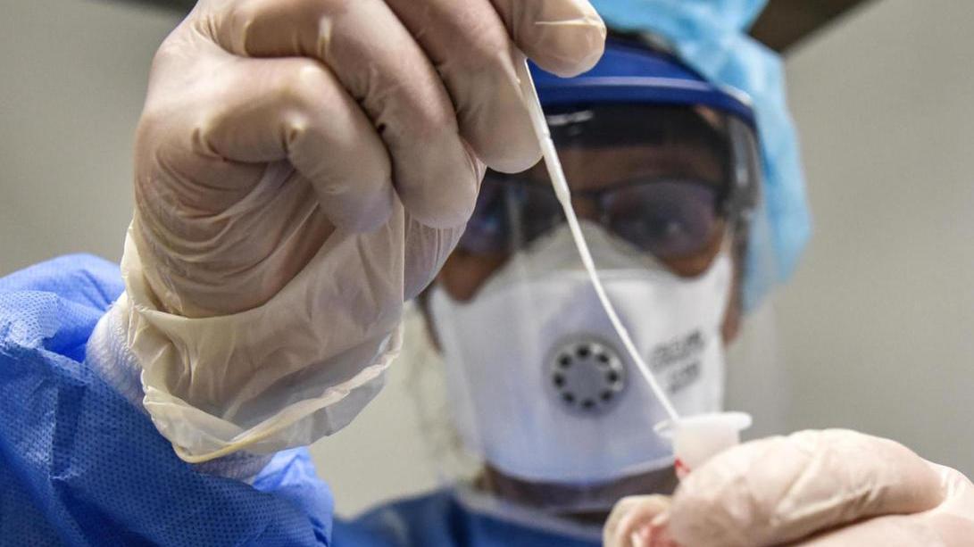 Il listino prezzi dei test: 65 euro per il tampone