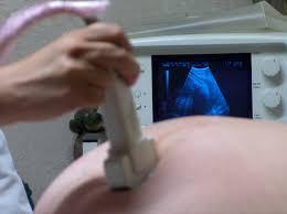 Un’ecografia prenatale
