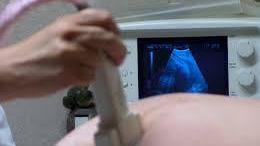 Un’ecografia prenatale