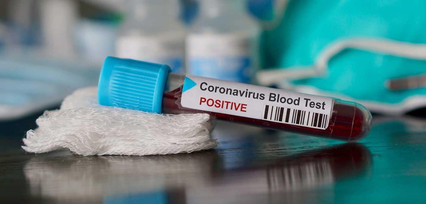 Covid, 67 nuovi casi in provincia di Lucca 