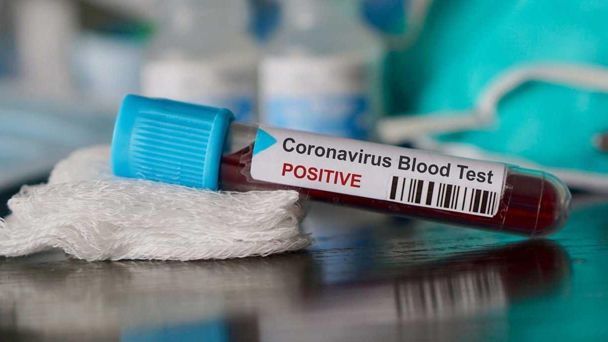 Covid, 67 nuovi casi in provincia di Lucca