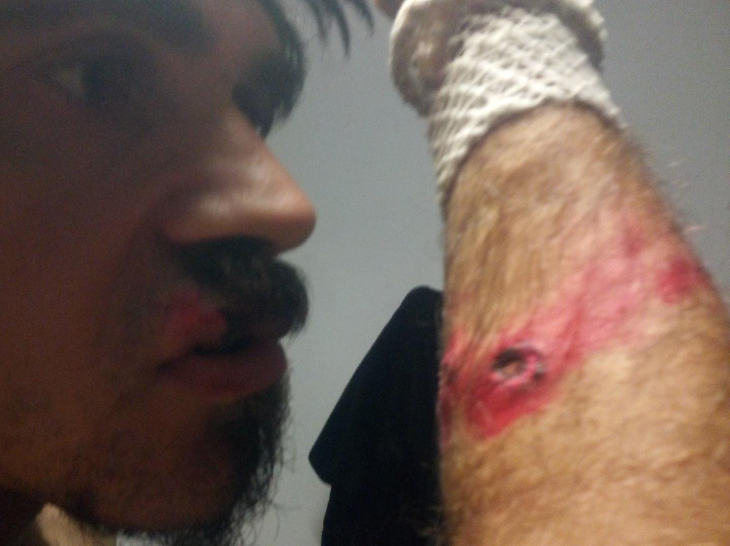 Ferito al braccio e al viso, il giudice riapre il caso 