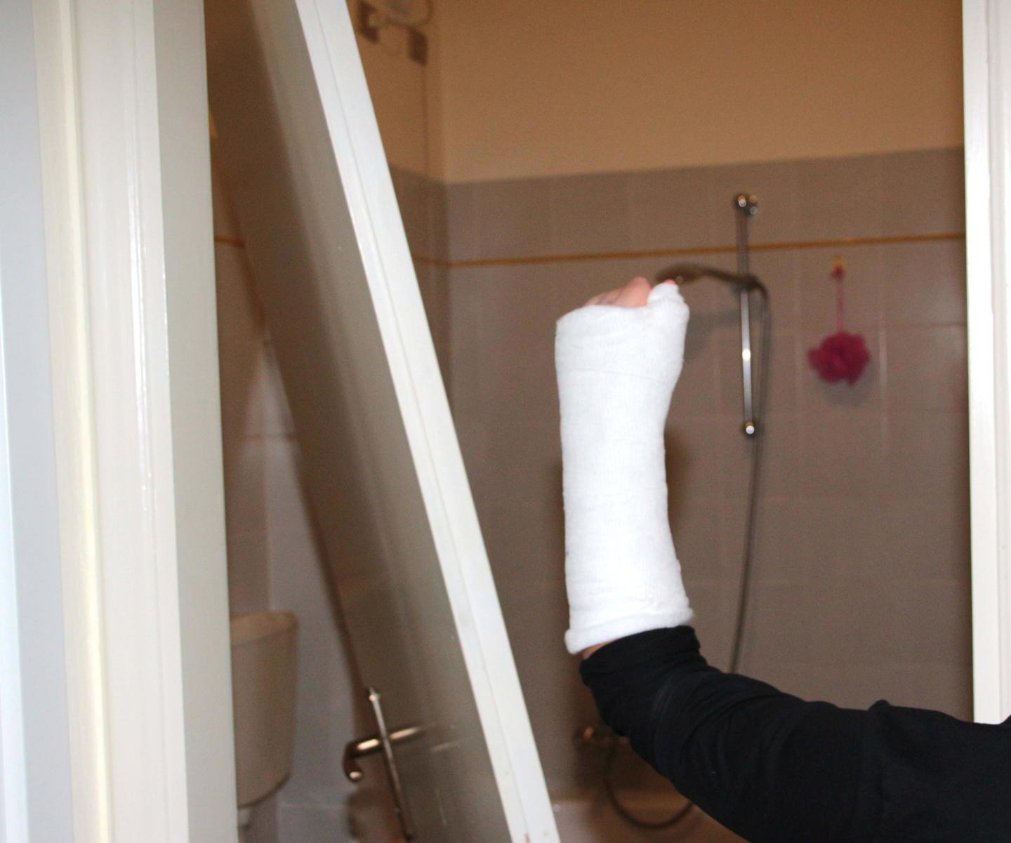 Case popolari, si stacca la porta del bagno e ferisce un bambino 