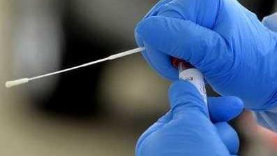 Covid, 25 casi nel Comune di Lucca Ma non c’è nessun nuovo focolaio