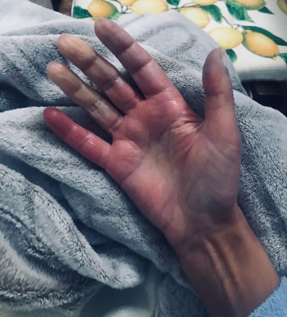 A Sassari cancellato il reparto malattie rare, i pazienti: per noi è la morte 