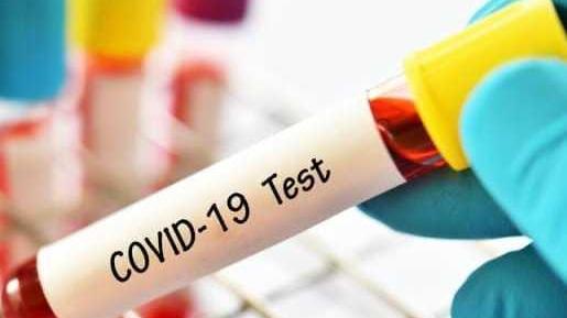 Due docenti positivi, 7 classi in quarantena