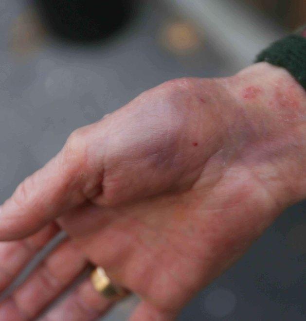 «Il rapinatore mi ha ferita con la siringa ma nessuno è intervenuto per aiutarmi» 