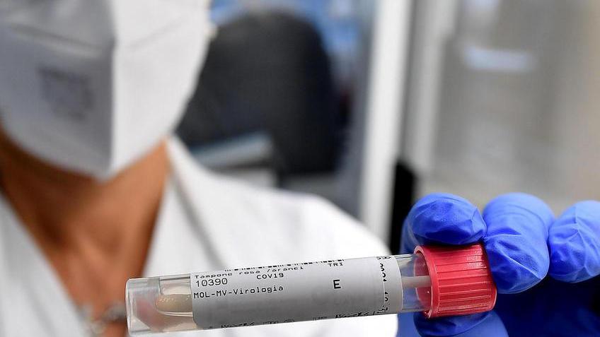 Covid, un’altra vittima in provincia terapia intensiva quasi al completo