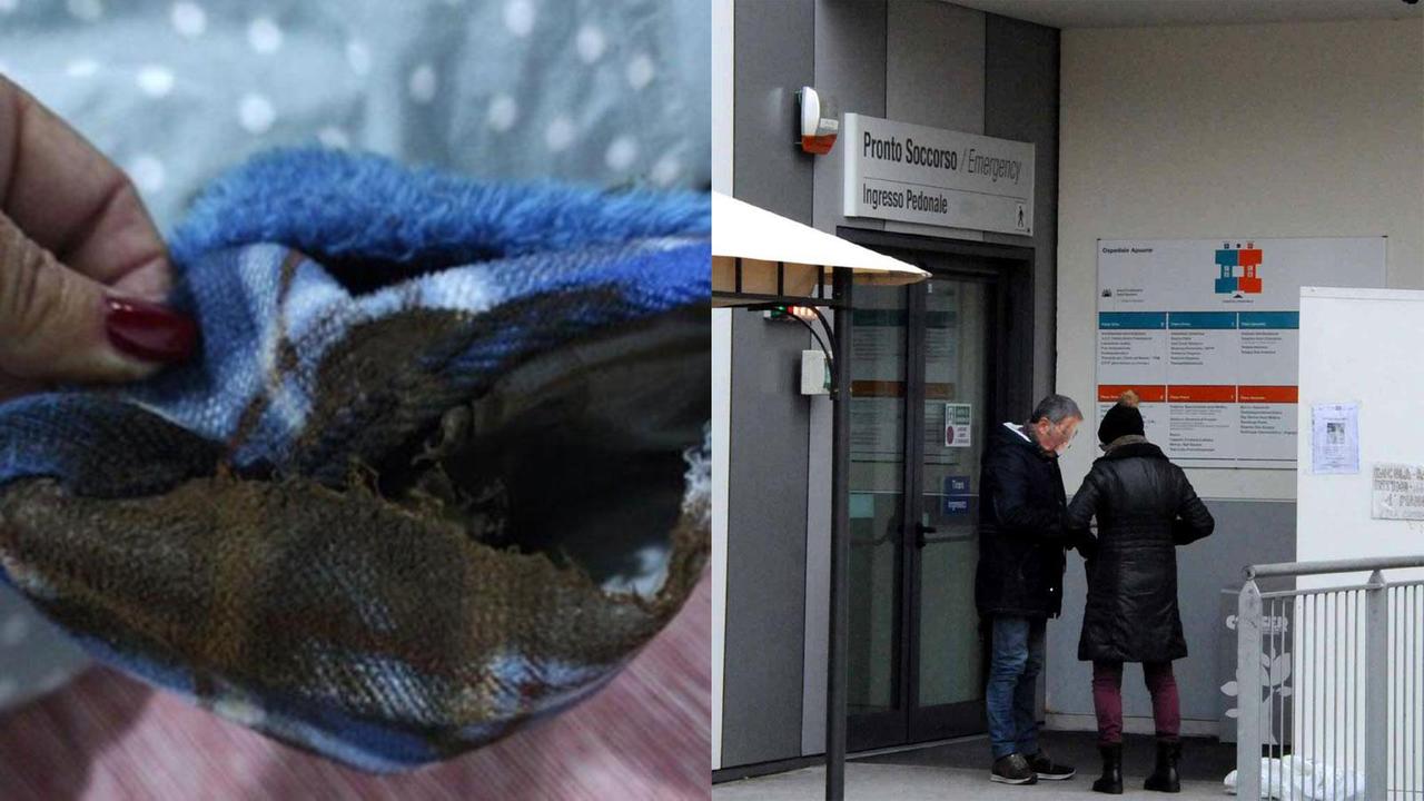 La borsa elettrica esplosa e l'ingresso del pronto soccorso di Massa