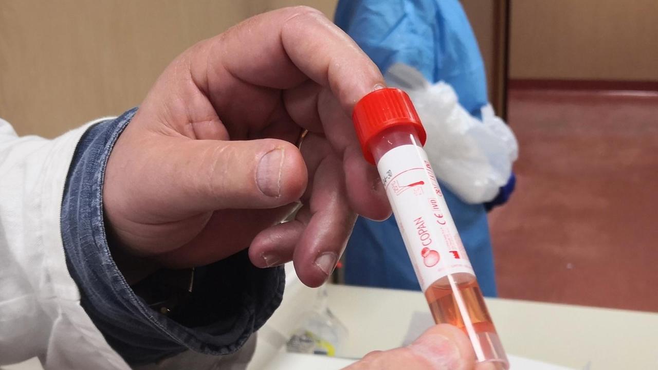 Viaggio nel laboratorio Aou tanti test e poco personale