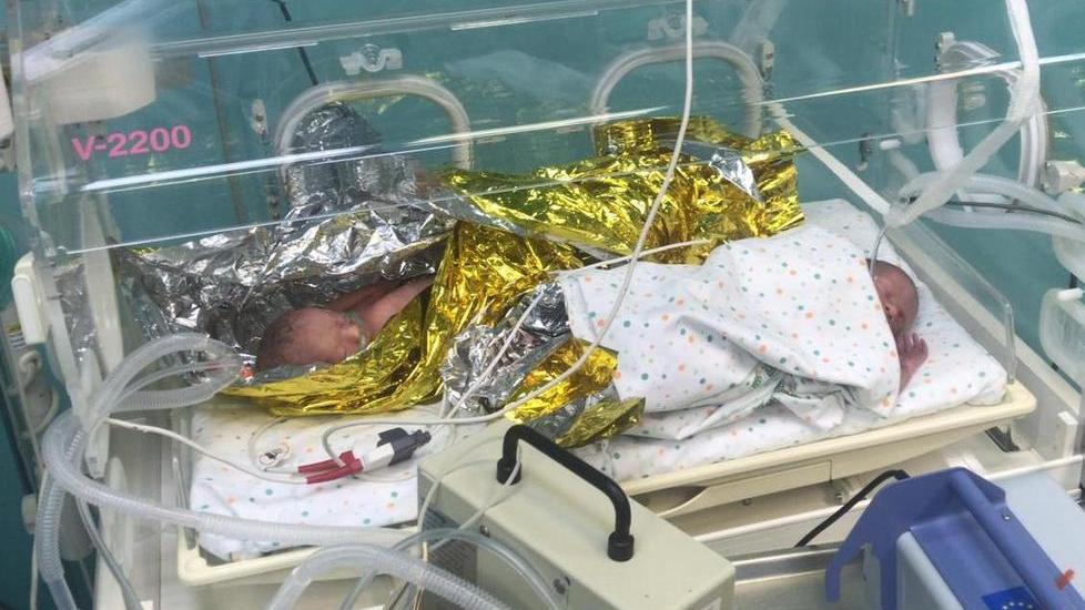 Benvenute Eva e Sofia, le due gemelline premature nate nell’ospedale elbano