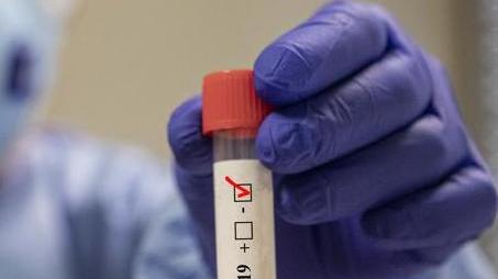 Cresce il numero dei pazienti in terapia intensiva