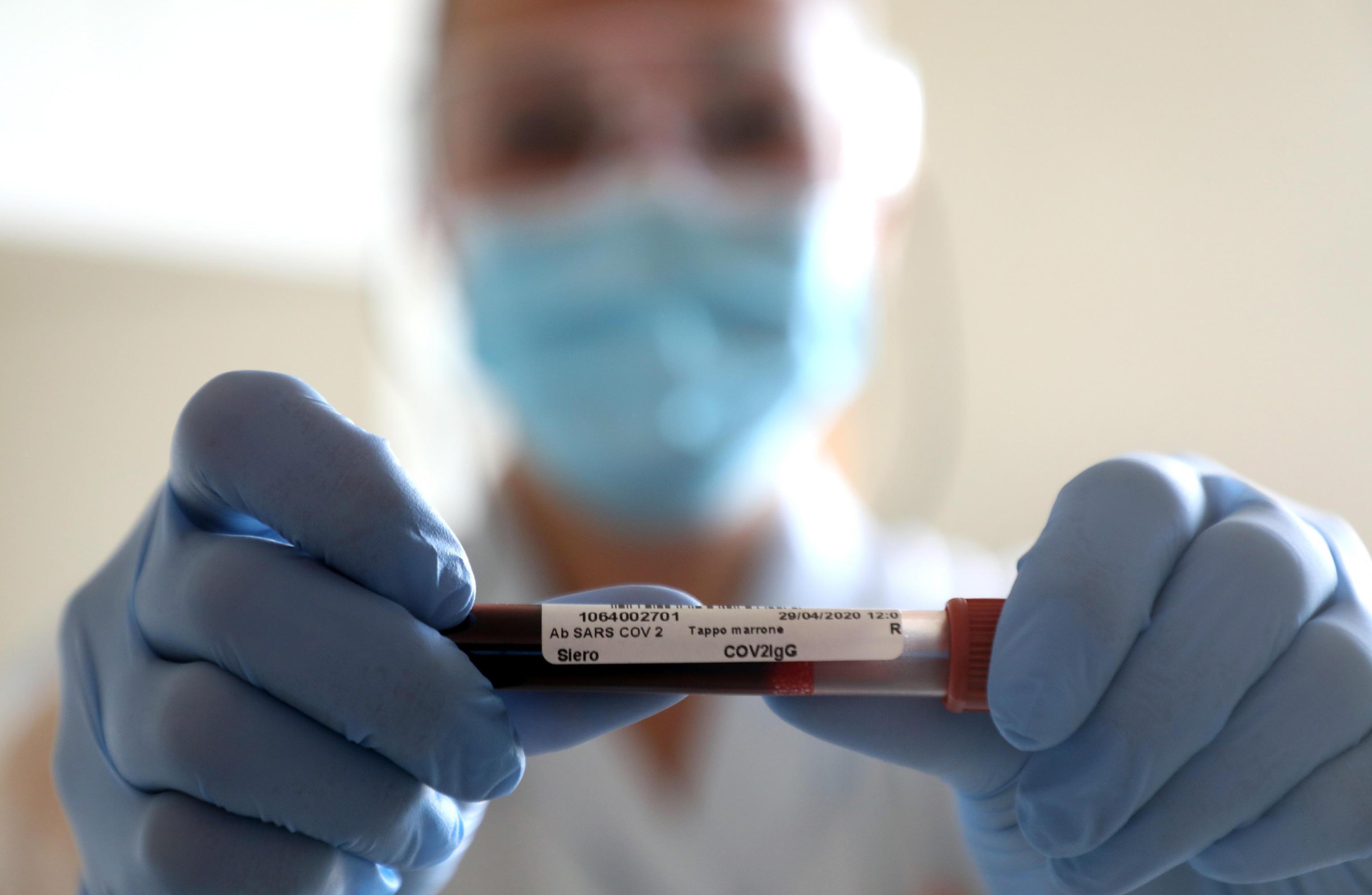 Coronavirus in Sardegna: 228 nuovi positivi, 11 morti e 421 guariti 