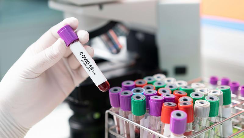 Covid, solo 12 nuovi casi ma ancora tre decessi: un medico di 63 anni tra le vittime 